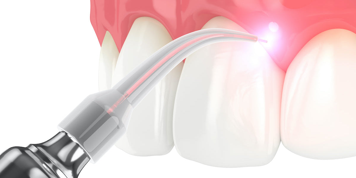 Esthetics and Lasers: Small Changes, Big Impacts!