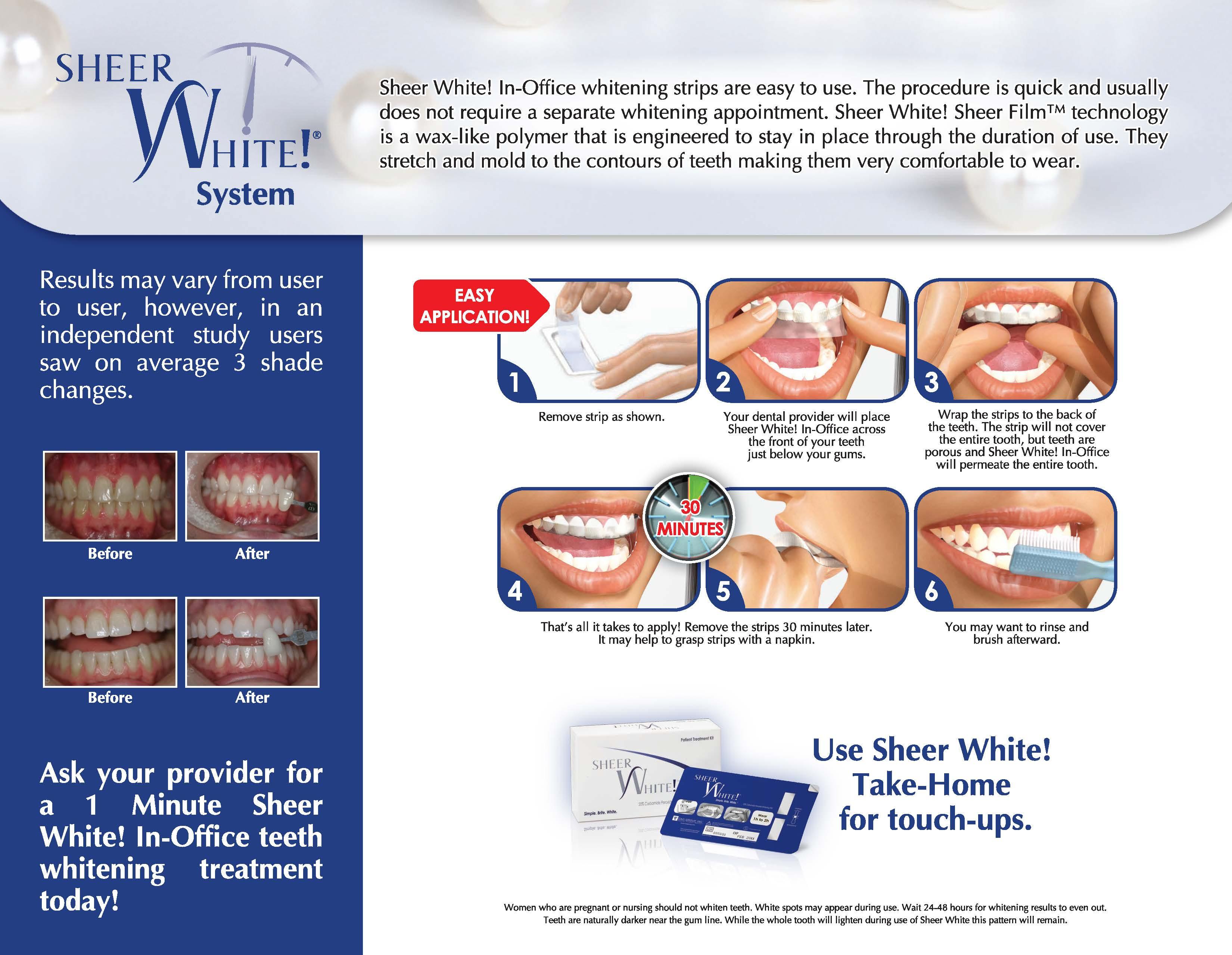 Sheer White! In-Office Patient Flyer - amdlasers